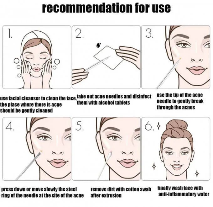 Aiguille d'élimination des points noirs