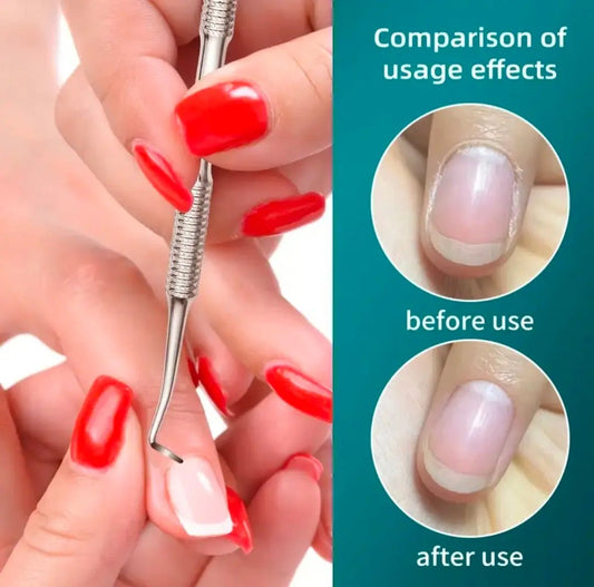 Outils d'ongle incarné, nettoyage pro