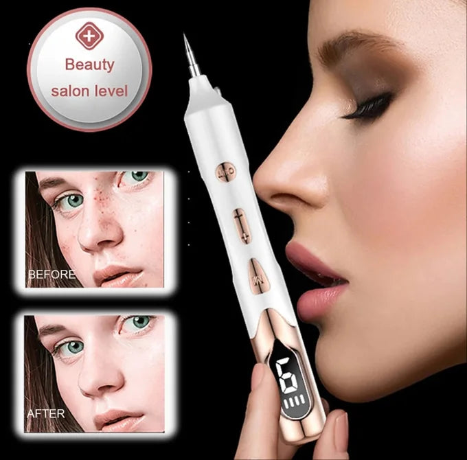 Plasma pen les taches de rousseur tatouages