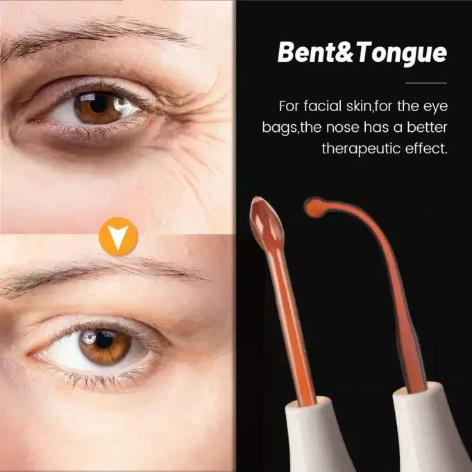 Baguette d'électrode haute fréquence Original