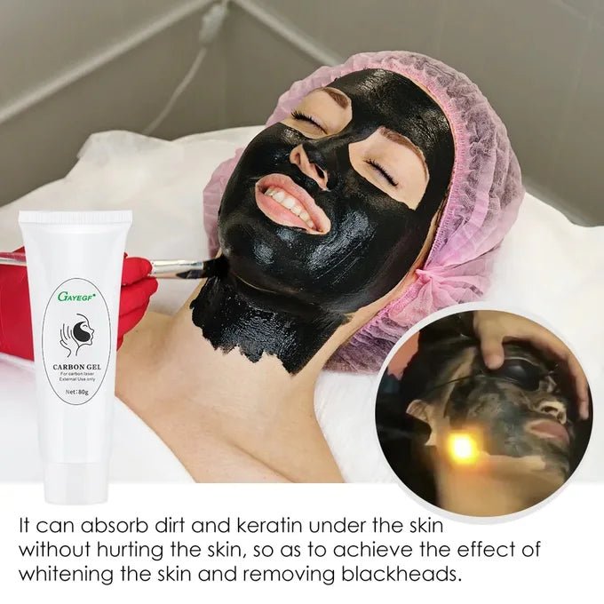 Carbon gel laser traitement 80g