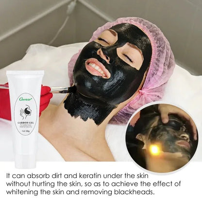 Carbon gel laser traitement 80g