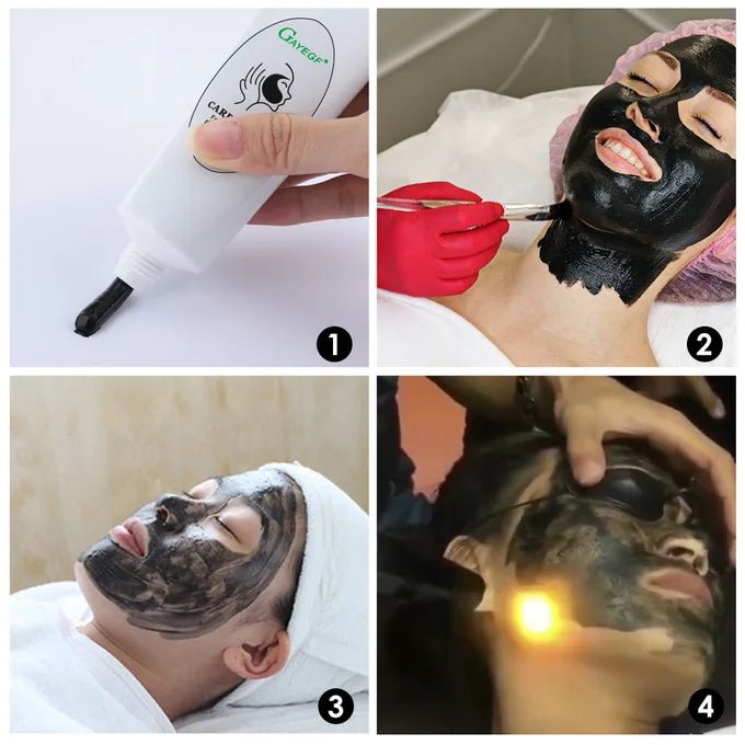 Carbon gel laser traitement 80g