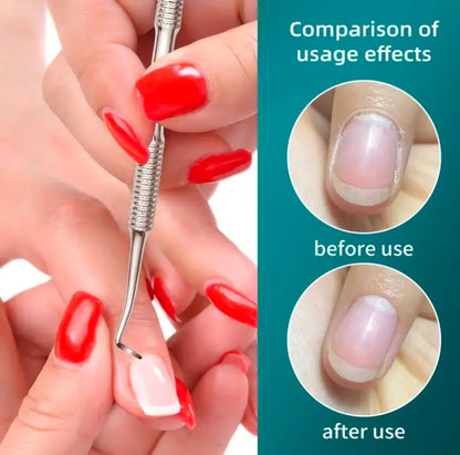 Outils d'ongle incarné, nettoyage pro